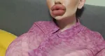 Cum arată femeia cu cele mai mari buze din lume. Şi-a injectat acid hialuronic de peste 25 de ori FOTO