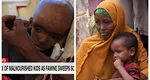 Imaginile foametei! Mamele din Somalia își îngroapă copiii morți de malnutriție! Efectele ucigătoare ale războiului pe care nu le vezi la televizor! 92% din hrana lor venea din Rusia și Ucraina