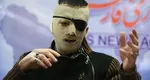 Ochi pentru ochi, deşi suntem în 2022 legea talionului încă se aplică. Justiţia i-a condamnat pe trei iranieni să li se scoată câte un ochi