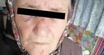 Bunicuță din Vaslui, cotonogită pentru un pumn de tămâie. Agresorul credea că femeia de 85 de ani „umblă cu vrăji” împotriva iubitei sale