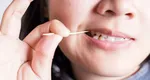 Scobitorile, extrem de periculoase pentru dinți. Ce spune un medic stomatolog despre utilizarea acestora: „Pot provoca boli serioase ale gingiilor”