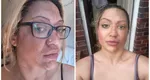 Un truc viral pe TikTok i-a ars fața unei femei. Victima trage un semnal de alarmă: „Un moment terifiant, am fost într-o agonie absolută”