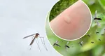 De ce unele persoane sunt pișcate mai des de țânțari decât altele. Verdictul medicului