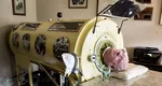 S-a stins din viață bărbatul de 78 de a ani care a trăit 7 decenii într-un  „plămân de fier”