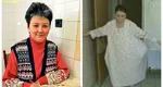 Ce face acum Lucica Bunghez, femeia care a avut o tumoare de 72 de kilograme. Cazul ei a fost unic în medicina mondială