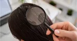 Produsul simplu care costă aproape 2 lei și te scapă de mătreață. Poate fi găsit în toate supermarketurile