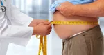 Studiu SRCM: 6 din 10 români sunt supraponderali sau obezi: „Vorbim despre o adevărată pandemie a obezității”