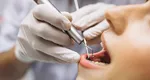 Fals medic dentist, arestat după mai multe plângeri ale pacienților. Fixa coroanele dentare cu superglue