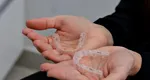 Aparat dentar Invisalign: tratament și confort pentru un zâmbet perfect!