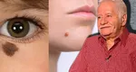 Mihai Voropchievici, despre semnificația semnelor din naștere: ”Apar la oamenii aleși”