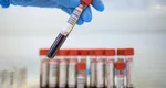 Analize gratuite pentru această categorie de români. Este nevoie doar de trimitere de la medicul de familie