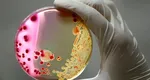 Cum se transmite și cum se tratează Serratia marcescens, bacteria care a omorât șase copii la Spitalul Sfânta Maria din Iași