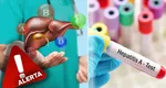 Alertă sanitară în România! 7 focare de hepatita A, depistate în mai multe localități din țară