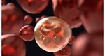 Bolnavii de leucemie au o nouă speranță. Cercetătorii au descoperit un tratament care omoară celulele canceroase