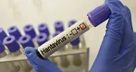 Primul caz de hantavirus, confirmat în România! Reacția Institutului Național de Sănătate Publică