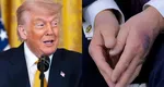 Donald Trump va efectua controlul medical anual pe 26 mai. Tot mai multe întrebări despre starea de sănătate a președintelui după ce a fost văzut cu vânătăi pe mâini