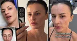 Influencerița Rux și Opulență, apariție șocantă pe stradă după un tratament facial de ultimă generație: „Arăt superb și așa. Am trăsături roiale”. Cât costă procedura