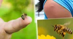 Cum trebuie să procedezi atunci când ești înțepat de o albină sau viespe. Remediul natural care te ajută