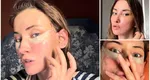 Iulia Albu recunoaște că a apelat la medicul estetician: „Nu vreau să arăt altfel, nu vreau buze mai mari, nici trăsături schimbate”
