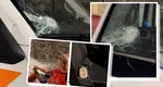 Mărturii șocante ale șoferul Ambulanței atacate la Cluj: ”A intrat în sala de operaţie cu mine de urgenţă şi a pus aproximativ nouă fire pe cornee”