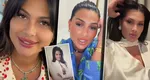 Soția lui Florin Salam, adevărul despre intervențiile estetice pe care le are: „Și la 17 ani aveam tot multe operații”