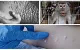 Principalele surse ale infectărilor cu variola maimuţei: o petrecere LGBT în Spania şi un festival cu zeci de mii de oameni în Belgia