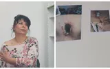 Pacientă arsă în aparatul RMN, la o clinică privată. O femeie a trecut prin clipe de coșmar