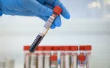 Ce se întâmplă cu analizele medicale la stat. S-a schimbat legea, ce trebuie să ştie românii de la 1 iulie 2023