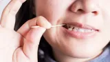 Scobitorile, extrem de periculoase pentru dinți. Ce spune un medic stomatolog despre utilizarea acestora: „Pot provoca boli serioase ale gingiilor”
