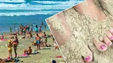 Ce boli se pot ascunde în nisipul de pe plajă. Cum să te ferești de ele