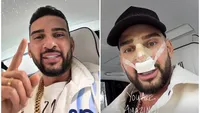 Dorian Popa și-a făcut operație de rinoplastie: „Am o coastă-n nas cum s-ar spune”. Cum se simte vlogger-ul după intervenția chirurgicală