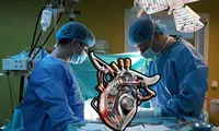 Primul transplant de inimă artificială: o fată de 17 ani trăiește datorită medicilor din Târgu-Mureș