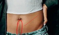 Linea nigra, linia secretă care apare pe abdomen în timpul sarcinii și nu doar