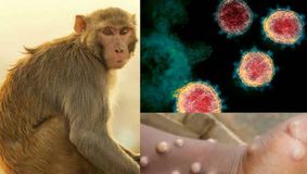 ȘOC Român confirmat cu variola maimuței în Grecia. Cu ce simptome se confruntă