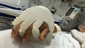 “Mâna lui Dumnezeu”. Imaginea surprinsă într-un salon de terapie intensivă din Brazilia a făcut înconjurul lumii
