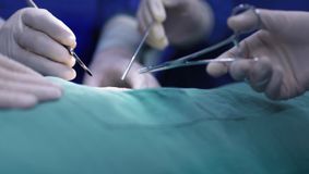O tumoră record de 45 de kilograme, extirpată din abdomenul unei femei din Botoșani