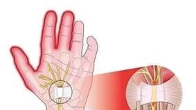 Amorțirea mâinilor și picioarelor: semnal de alarmă pentru bolile grave. Cele 5 cauze care necesită vizita urgentă la medic