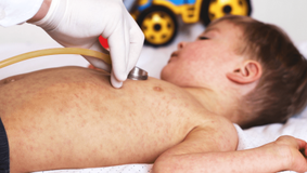 Avertismentul unui pediatru: „Vor veni înapoi maladii care omorau frecvent copiii în trecut“