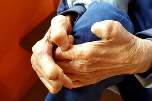 Ministrul Sănătății liniștește populația după cazul de lepră de la Cluj: „Nu există risc pentru clienții salonului”