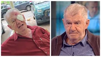 Florin Zamfirescu trece prin momente cumplite. Accidentul care aproape că l-a lăsat orb, după operația de cataractă: „M-am împiedicat, erau niște denivelări” VIDEO