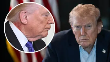 Donald Trump a putut fi văzut cu o erupție cutanată roșie pe gât în prima sa apariție publică de la atacul asupra Iranului. Doctorul Casei Albe explică motivul