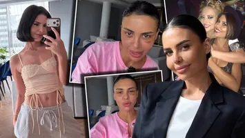 Andreea Popescu s-a tunat. Cum arată acum fosta soție a lui Rareș Cojoc, ce operații estetice și-a făcut: „Mi-a căzut părul enorm, pielea a arătat horror. Încă am aceste vânătăi” VIDEO
