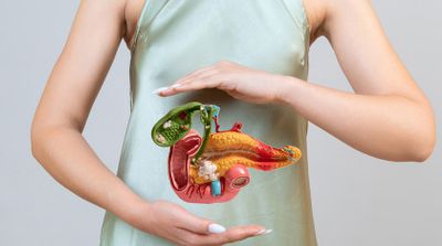 5 alimente care provoacă cancer pancreatic fără să-ți dai seama