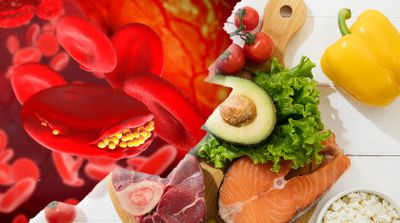 Alimentele care îți cresc nivelul de colesterol. Trebuie neapărat să eviți să le consumi