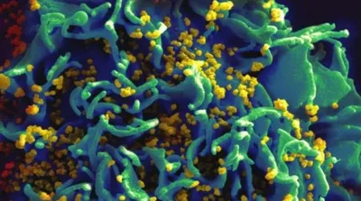 Care sunt simptomele infectării cu HIV? Dr. Carmen Dorobăț: „Boala poate debuta cu manifestări neurologice, poate debuta cu manifestări din sfera ORL” - VIDEO