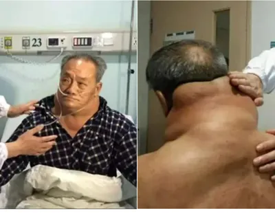 El este Tan, bărbatul care a băut zilnic alcool, timp de 30 de ani! Medicii au fost șocați când l-au văzut VIDEO