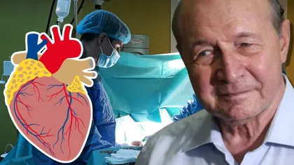 EXCLUSIV Traian Băsescu a fost operat pe inimă la Paris. Clipe de cumpănă pentru fostul președinte
