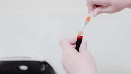Măsură extremă după moartea rezidentului de la Floreasca. Medicii care intră în gardă ar putea fi testați antidrog!