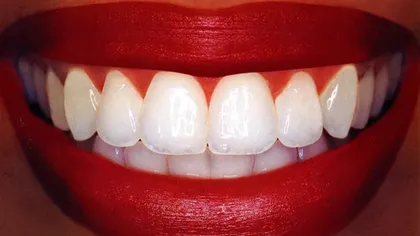 Trucuri naturale de albire a dinţilor
