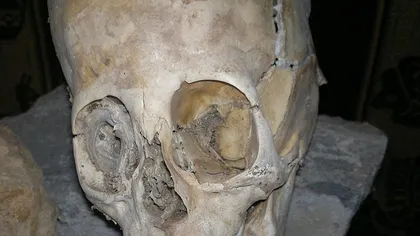 Descoperire neaşteptată: Este acesta craniul unui extraterestru?